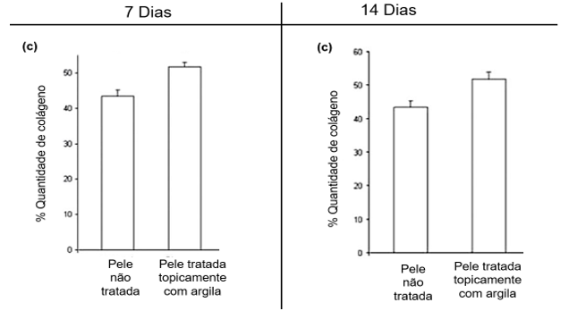 Notas de estudo sobre argiloterapia, importância da argila nos tratamentos  estéticos, Notas de estudo Português (Gramática - Literatura)